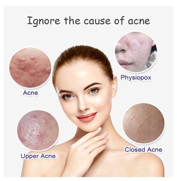 AICHUN BEAUTY Anti-Acne Facial Serum Aloe Vera Extract - Image 4