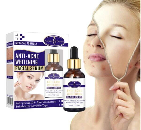 AICHUN BEAUTY Anti-Acne Facial Serum Aloe Vera Extract - Image 3
